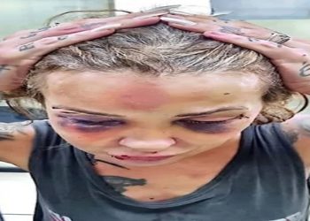 Homem tortura namorada com cassetete e soco ingles no RJ