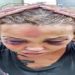 Homem tortura namorada com cassetete e soco ingles no RJ