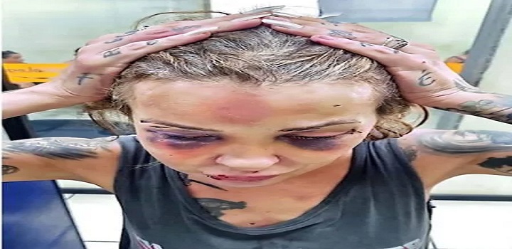 Homem tortura namorada com cassetete e soco ingles no RJ