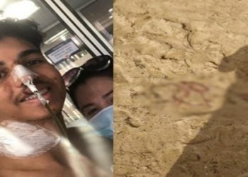 ovem que teve barriga cortada diz que polícia não considerou outros aspectos do caso Gabriel Muniz publicou vídeo no Instagram O jovem Gabriel Muniz, de 22 anos, falou sobre o caso em que teve a barriga cortada e parte do intestino retirado em uma praia de Guarapari (ES),