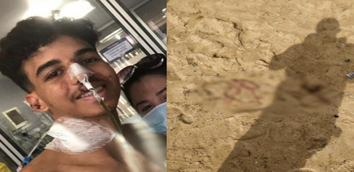 ovem que teve barriga cortada diz que polícia não considerou outros aspectos do caso Gabriel Muniz publicou vídeo no Instagram O jovem Gabriel Muniz, de 22 anos, falou sobre o caso em que teve a barriga cortada e parte do intestino retirado em uma praia de Guarapari (ES),