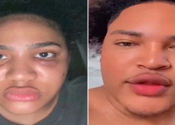 Kelly Pereira. Influencer sofre agressões de namorado