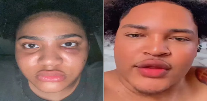 Kelly Pereira. Influencer sofre agressões de namorado
