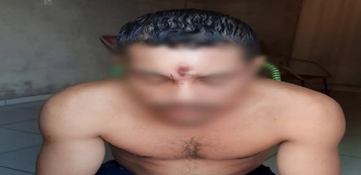 hOMEM BALEADO NA CABEÇA NO TOCANTINS