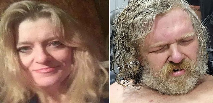 Mulher acorda de coma e identifica irmao como agressor