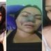 Uma mulher de 37 anos denuncia que teve parte do nariz necrosado e ficou com sequelas após um procedimento estético para afinar o nariz com um dentista de Aparecida de Goiânia, Região Metropolitana da capital. Elielma Carvalho Braga