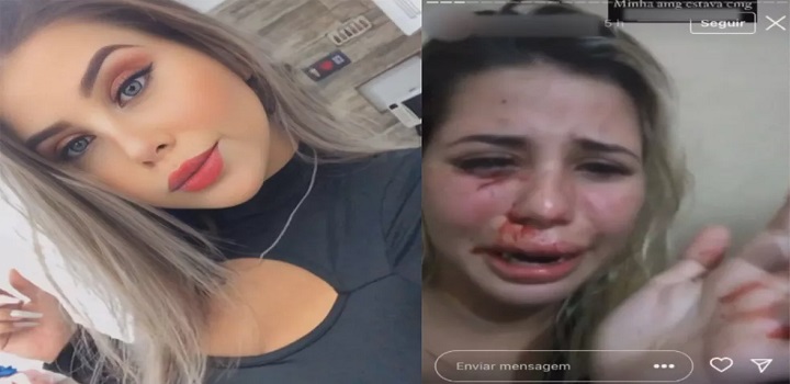 modelo e influencer amanda souza agredida pelo namorado vanderlei bambam