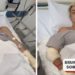 Funcionários de hospital onde Bruno Krupp ficou internado relatam que modelo foi 'rude' e 'agressivo'