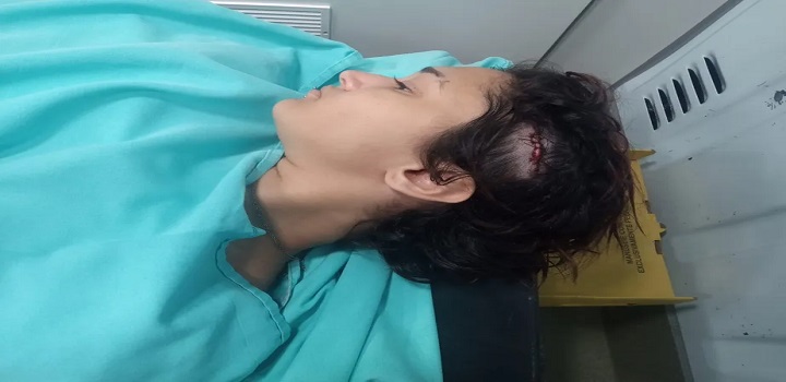 Uma jovem de 19 anos foi agredida em um bar de Angra dos Reis, na Costa Verde do Rio, depois de, em uma conversa com amigos, serem feitas críticas ao presidente Jair Bolsonaro