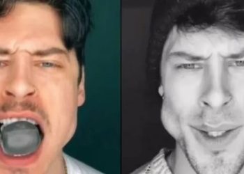 Morder pequenos objetos de silicone com a intenção de definir e demarcar os músculos da região do maxilar, através da hipertrofia. Essa é a "técnica" que viralizou no TikTok e tem por objetivo aumentar o tamanho da mandíbula