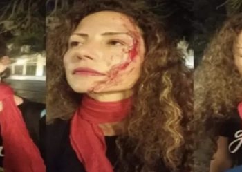Jornalista agredida por usar adesivo de lula
