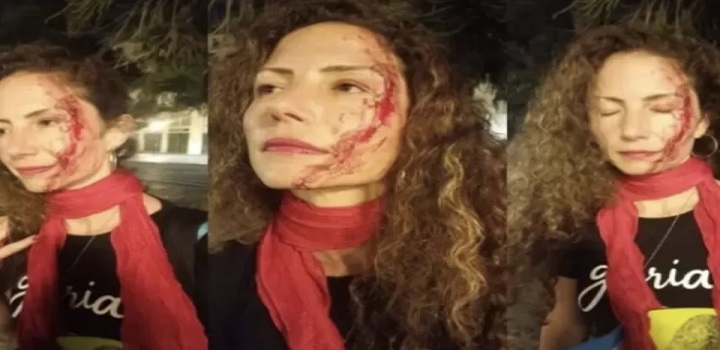 Jornalista agredida por usar adesivo de lula