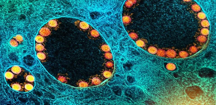 BQ.1: o que se sabe sobre variante da ômicron descoberta no Brasil — Foto: NIAD-NATIONAL INSTITUTE OF ALLERGY AND INFECTIOUS Uma nova variante