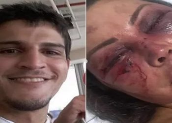 Vinicius e o rosto de Elaine após a agressão: ela sente dore até hoje — Foto: Reprodução/Instagram
