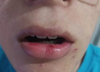 estudante autista agredido em onibus em maricá