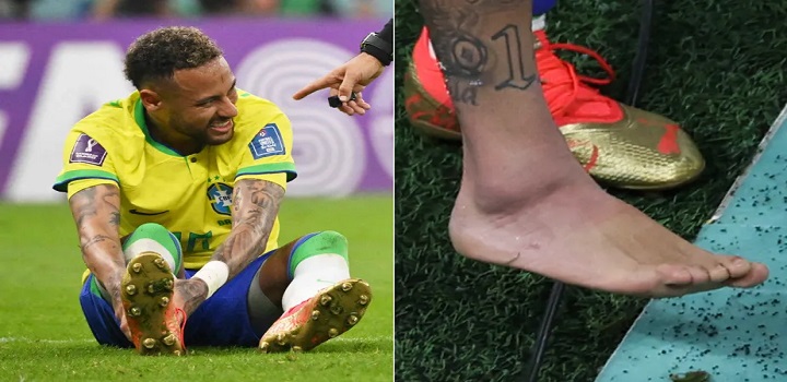lesão de neymar