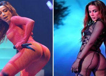 anitta faz procedimento no bumbum