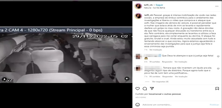 jOVEM QUE TEVE ROSTO CORTADO EM ONIBUS