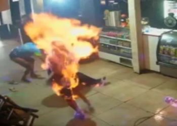 - Mulher teve 80% do corpo queimado durante discussão em bar;