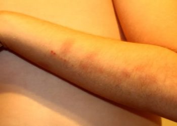 Brasileira denuncia agressoes a filho autista em portugal
