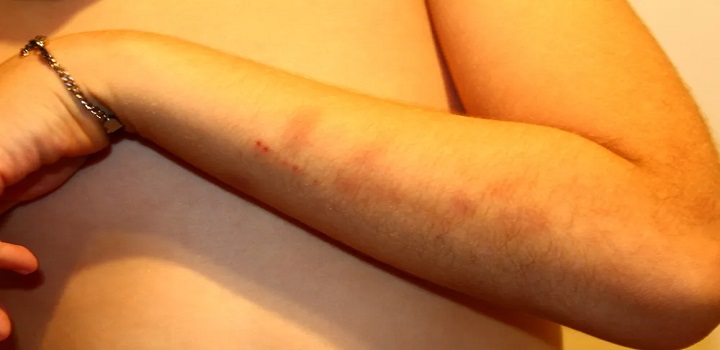 Brasileira denuncia agressoes a filho autista em portugal