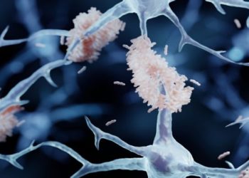 Chinês de 19 com Mal de Alzheimer