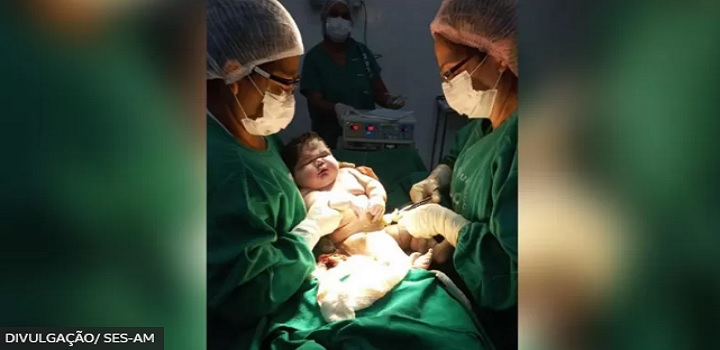 bebê gigante do amazonas