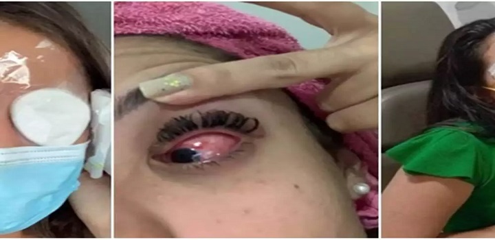 uso de pomadas, mulheres ficam cegas