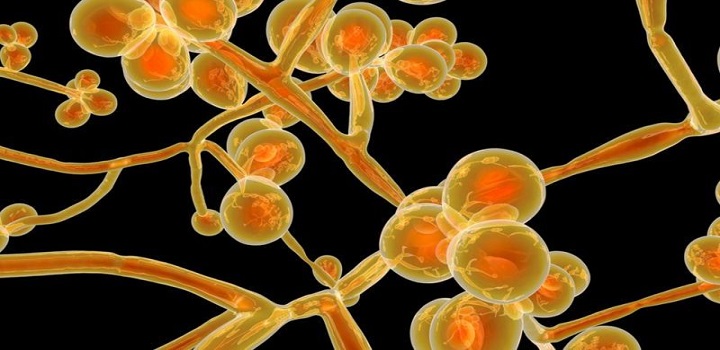 EUA INFECÇÃO CANDIDA AURIS