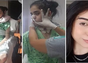 jovem internada após cheirar pimenta