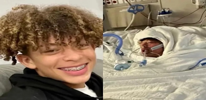 tik toker que teve corpo queimado nos eua