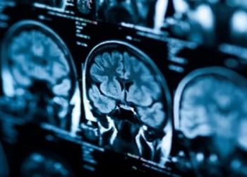 Novo modelo de inteligência artificial pode identificar casos de câncer em estágio inicial