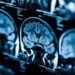 Novo modelo de inteligência artificial pode identificar casos de câncer em estágio inicial