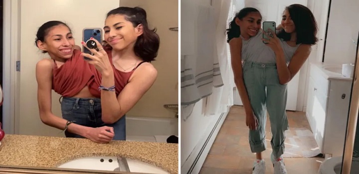 gemeas mexicanas siamesas do tik tok