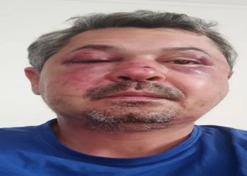 Saulo Jucá foi espancado durante ataque xenofóbico em Portugal