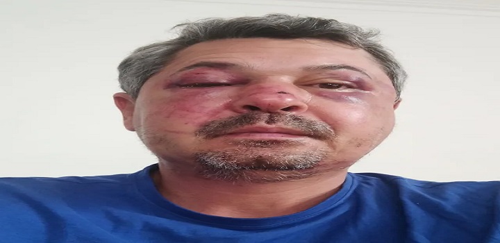 Saulo Jucá foi espancado durante ataque xenofóbico em Portugal