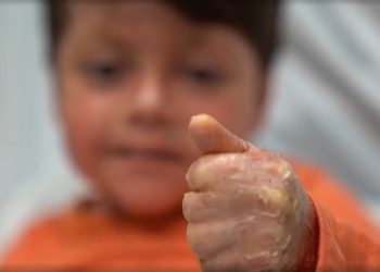 Menino que causou comoção ao acordar após 16 dias em coma conta qual foi sua primeira pergunta
