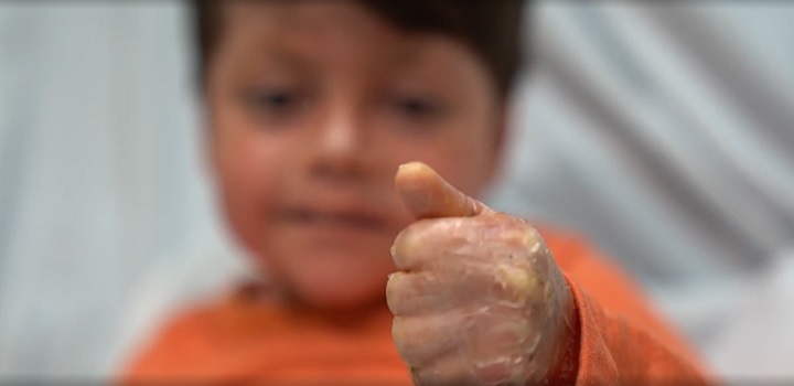 Menino que causou comoção ao acordar após 16 dias em coma conta qual foi sua primeira pergunta