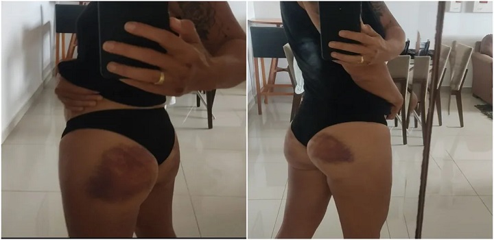 POLICIAL AGREDIDA EM CURSO NO CEARÁ