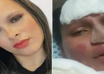 mulher queimada pelo marido em franca sp
