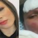 mulher queimada pelo marido em franca sp