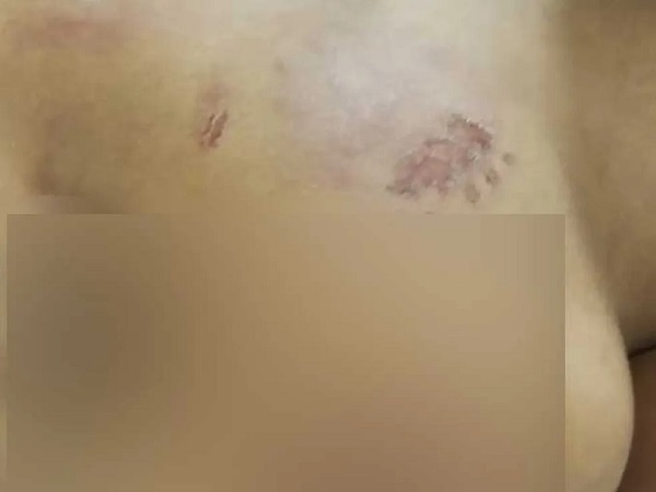 Marcas da violência sofrida pelo menino — Foto: Reprodução