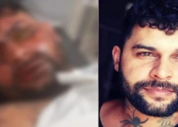 TATUADOR FICA CEGO APÓS NAMORADA JOGAR SODA CAUSTICA