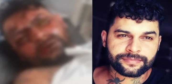 TATUADOR FICA CEGO APÓS NAMORADA JOGAR SODA CAUSTICA