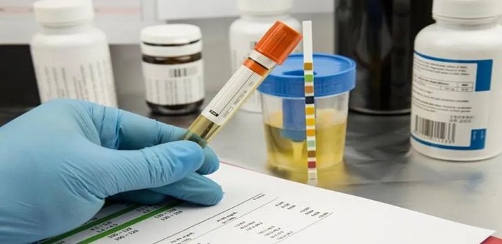 Um participante que consiga chegar ao fim das 24 semanas sem nenhum teste positivo poderá receber um valor total máximo de 599 dólares (cerca de R$ 2.480) — Foto: GETTY IMAGES