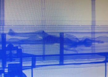scanner detecta corpo