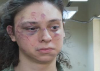 Homem é preso por agredir ator Victor Meyniel em Copacabana