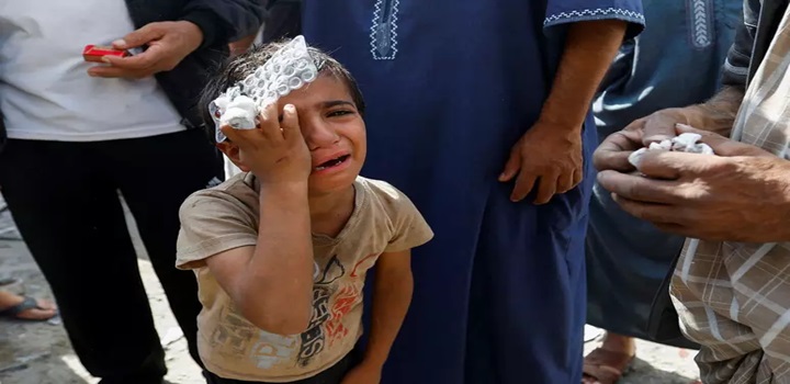 crianças e mulheres, estão passando por procedimentos cirúrgicos sem a sedação adequada em gaza