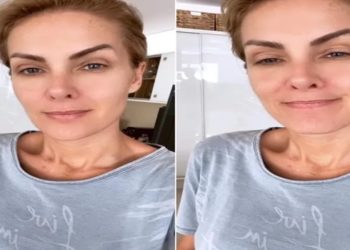 ana hickmann fala sobre agressao