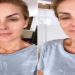 ana hickmann fala sobre agressao
